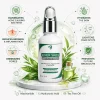 Ever Skin Anti Acne Serum