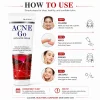 Acne-Go Anti-Acne Cream