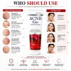 Acne-Go Anti-Acne Cream
